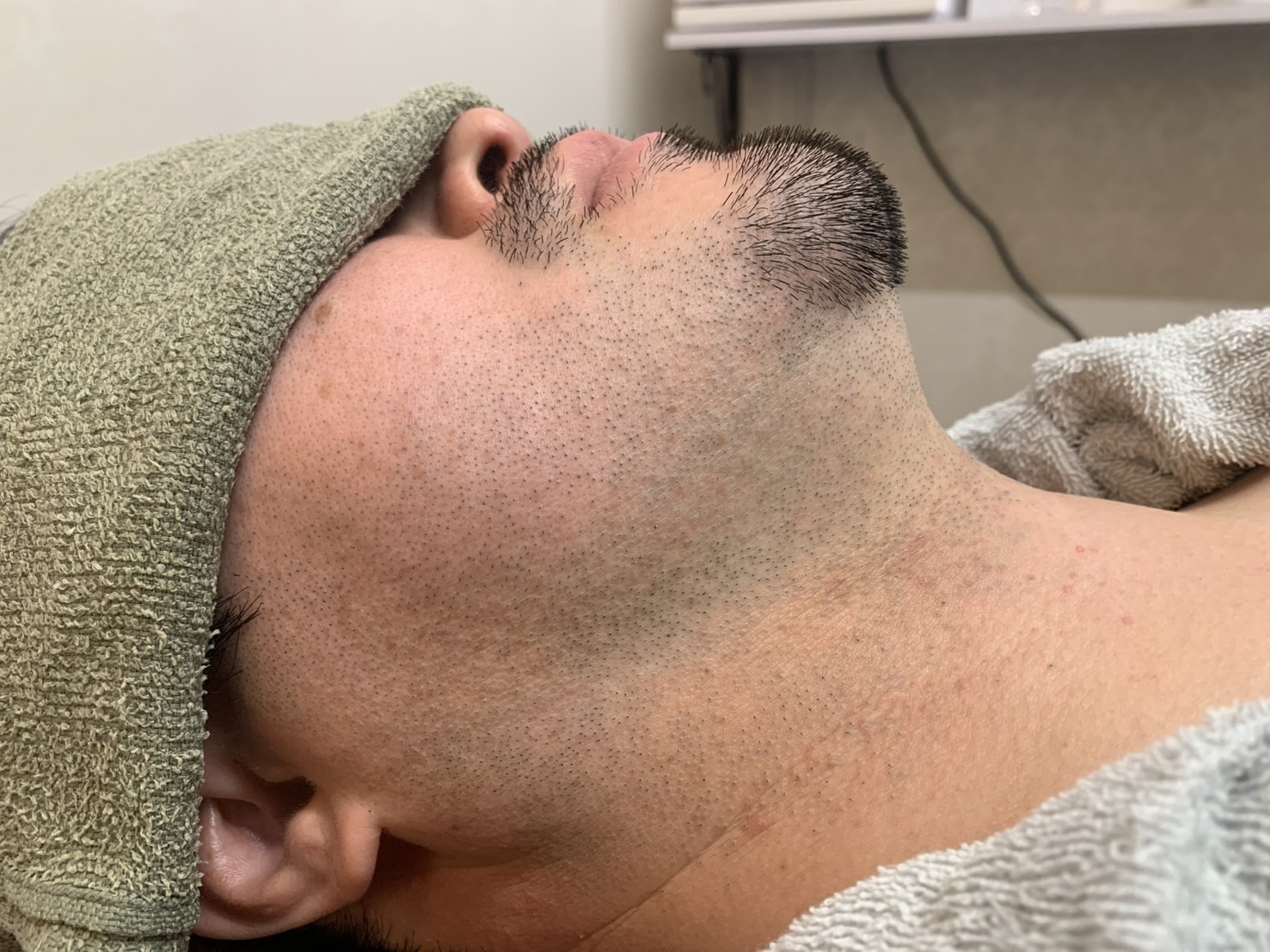 Before Image