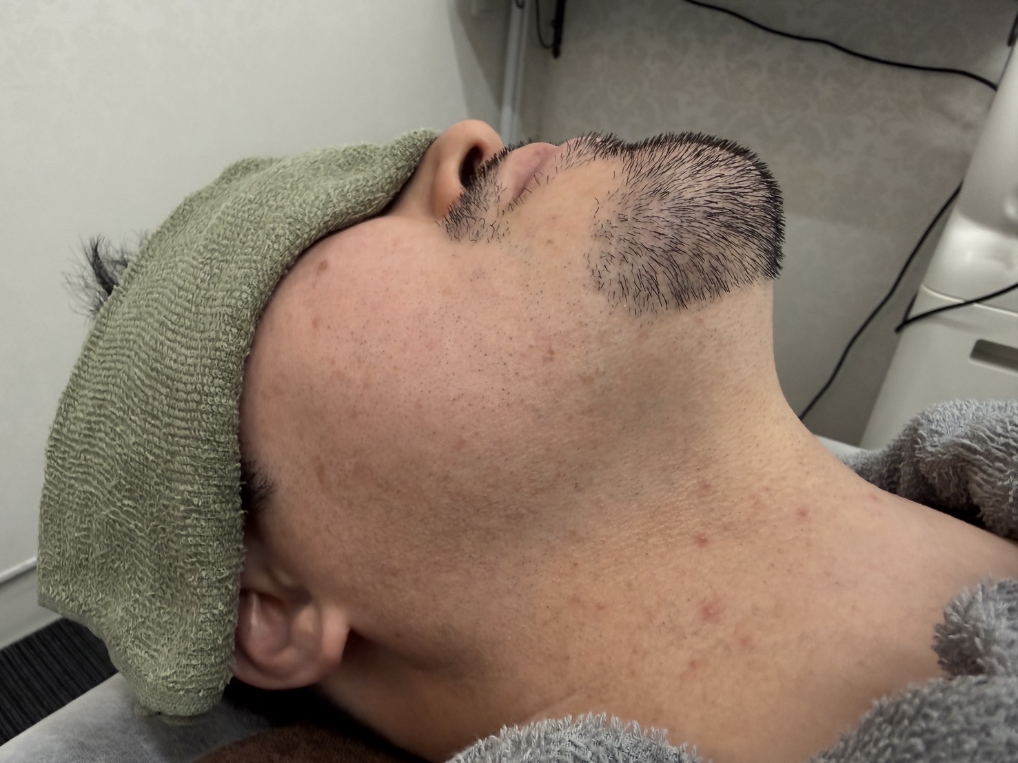 After Image